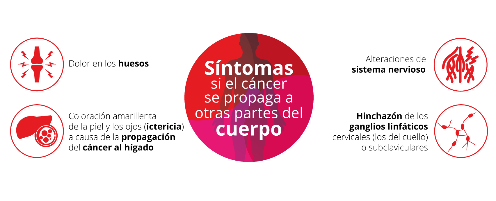 Síntomas si el cáncer se propaga