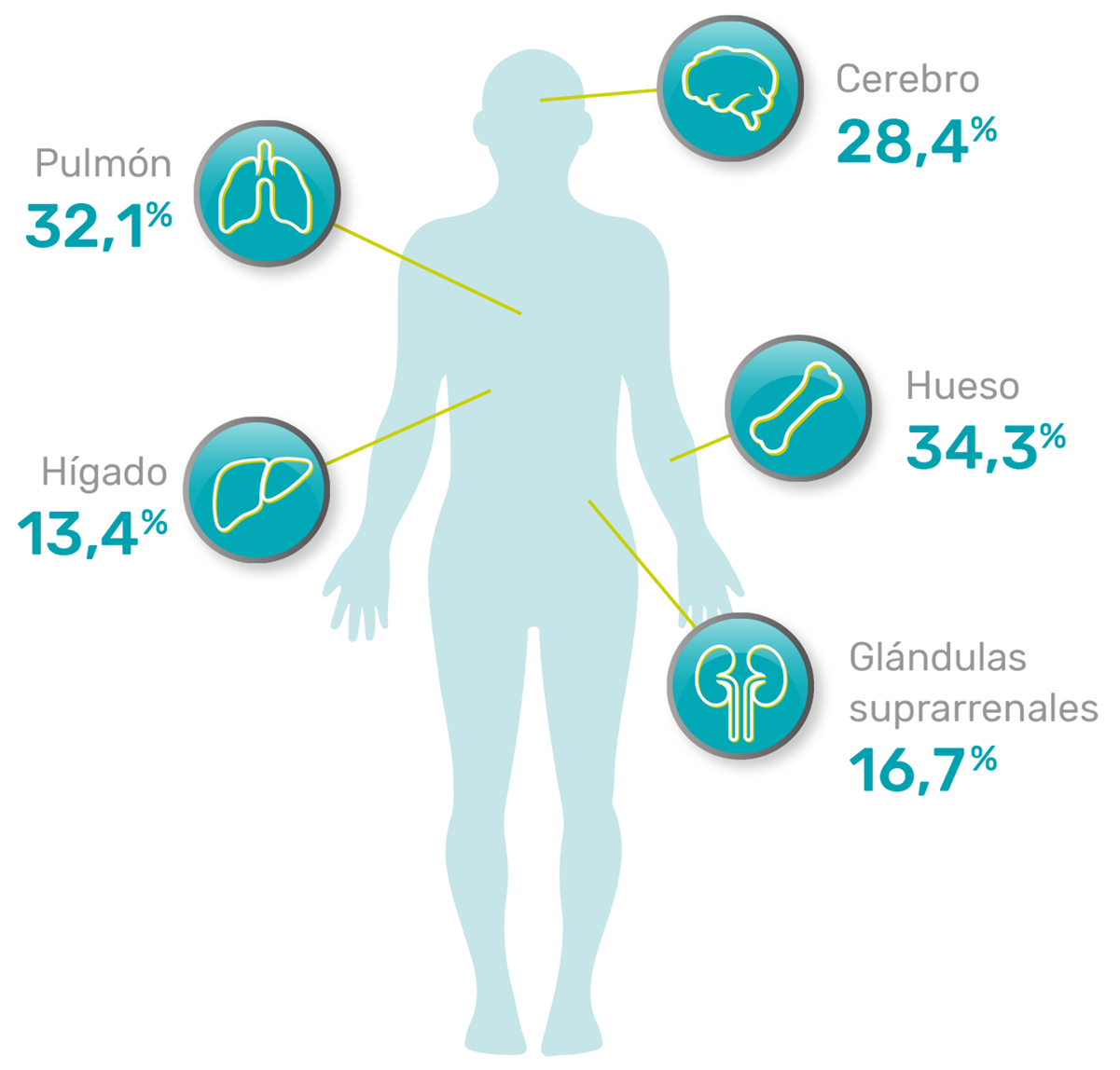 Tipo de metástasis del cáncer de pulmón